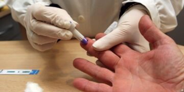 Día mundial de lucha contra el VIH: En Salta se detectan alrededor de 500 casos por año