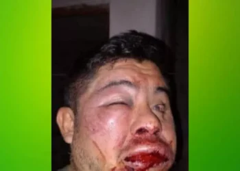 Lo desfiguraron en el baño de un boliche y la Policía no lo ayudó