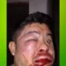 Lo desfiguraron en el baño de un boliche y la Policía no lo ayudó