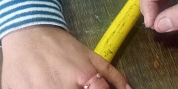 Bomberos asistieron a otra vecina para extraerle un anillo