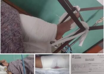 Lo chocaron, le quebraron la pierna y ahora necesita $ 2 millones