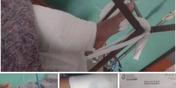 Lo chocaron, le quebraron la pierna y ahora necesita $ 2 millones