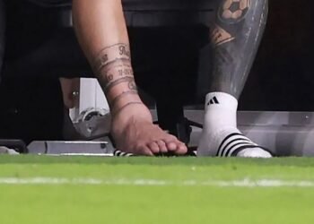 Se conoció la lesión de Messi