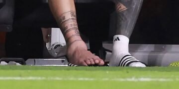 Se conoció la lesión de Messi