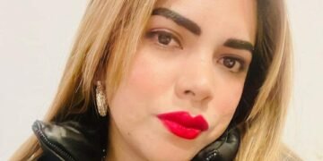 Comerciante de Orán fue salvajemente atacada por su ex pareja