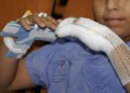 En Salta, más de 15 niños quemados en Navidad