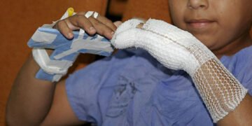 En Salta, más de 15 niños quemados en Navidad