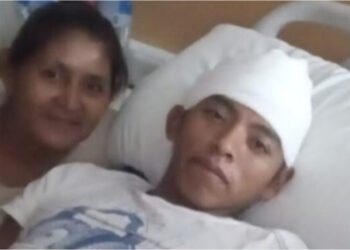 Bagayero perdió la mitad de la movilidad de su cuerpo tras enfrentamiento con Gendarmería
