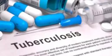 En el 2024 confirmaron en Salta 967 nuevos casos de tuberculosis