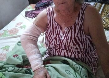 Desde marzo esperan que el PAMI les entregue una prótesis