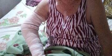 Desde marzo esperan que el PAMI les entregue una prótesis