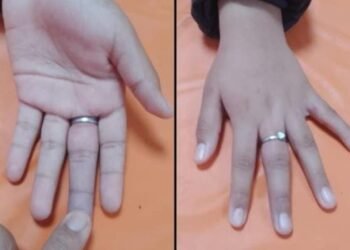 Sigue la extracción de anillos por parte de Bomberos Voluntarios