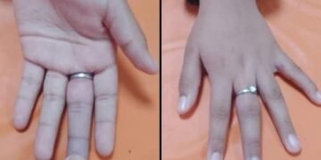 Sigue la extracción de anillos por parte de Bomberos Voluntarios