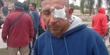 Brutal represión a los municipales en Hipólito Yrigoyen