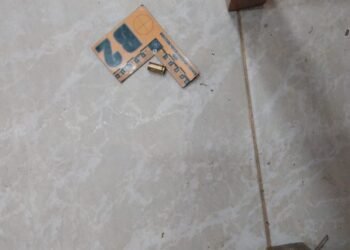 Por robarle le dispararon dos veces y salvó su vida de milagro