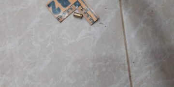 Por robarle le dispararon dos veces y salvó su vida de milagro