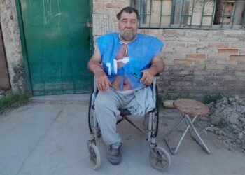 Le falta una pierna, quedó en silla de rueda y le tiraron agua hirviendo