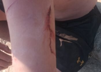 Jovencito fue macheteado para robarle la moto