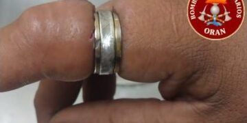 Bomberos Voluntarios sigue asistiendo a vecinos en la extracción de anillos