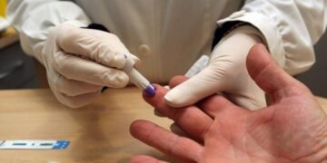 Este miércoles Campaña de Testeo Rápido de VIH y Sífilis