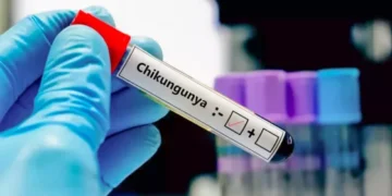 Salud confirma brote de Chikungunya en la frontera y refuerza acciones en el norte provincial