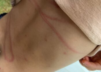 Agredió a su pareja con un cable