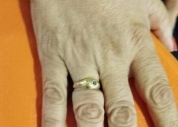 Bomberos Voluntarios extrajo otro anillo a una vecina