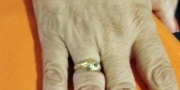 Bomberos Voluntarios extrajo otro anillo a una vecina