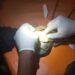 Bomberos extrajeron nuevamente un anillo a un vecino