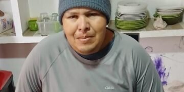 Tiene 37 años y si no se opera en breve quedará ciego