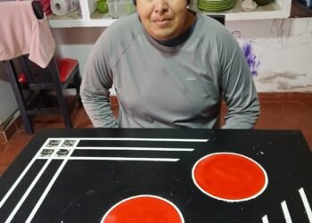 Tiene 37 años y si no se opera en breve quedará ciego