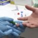 Salta suma 14 casos de hepatitis virales